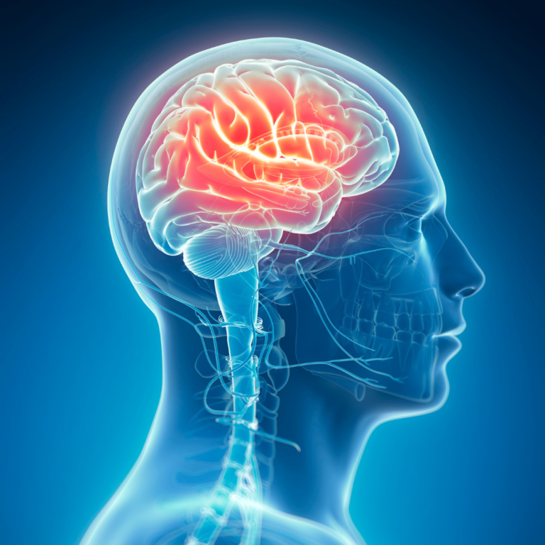 neurology
